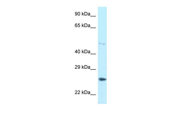 WB Suggested Anti-HNRNPF Antibody Titration: 1.0 ug/ml Positive Control: Jurkat Whole CellHNRNPF is supported by BioGPS gene expression data to be expressed in Jurkat
