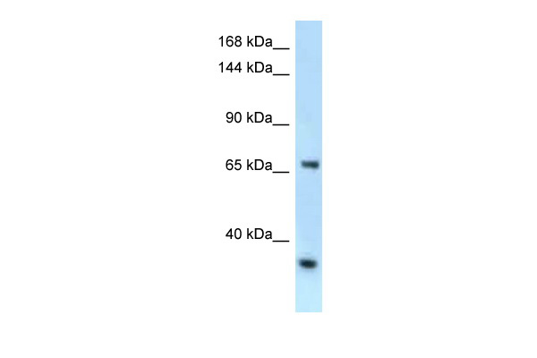 WB Suggested Anti-Rbm15b Antibody Titration: 1.0 ug/ml Positive Control: Mouse Heart