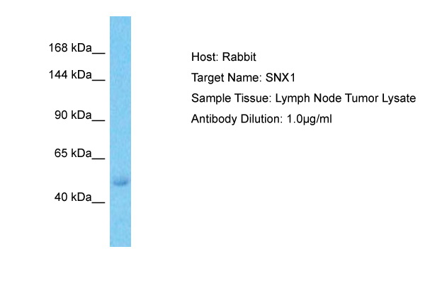 Host: Rabbit Target Name: SNX1 Sample Type: Lymph Node Tumor lysates Antibody Dilution: 1.0ug/ml