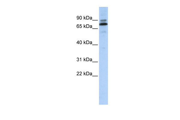 WB Suggested Anti-C14orf21 Antibody Titration: 0.2-1 ug/ml ELISA Titer: 1:312500 Positive Control: Hela cell lysate