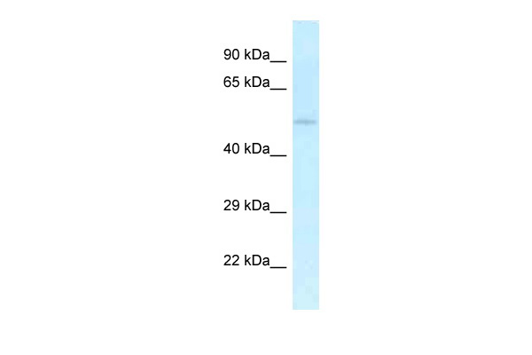 WB Suggested Anti-Uhmk1 Antibody Titration: 1.0 ug/ml Positive Control: Mouse Heart