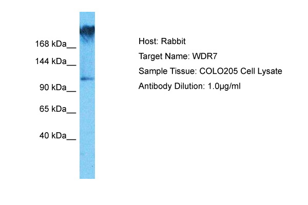 Host: Rabbit Target Name: WDR7 Sample Type: COLO205 Whole Cell lysates Antibody Dilution: 1.0ug/ml