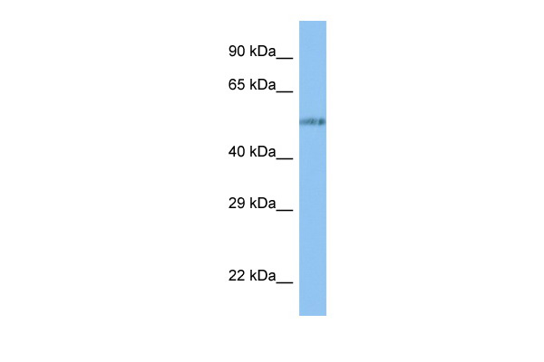 WB Suggested Anti-VANGL1 Antibody Titration: 1.0 ug/ml Positive Control: RPMI-8226 Whole Cell