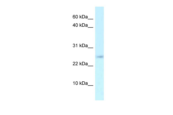 WB Suggested Anti-Arpp21 Antibody Titration: 1.0 ug/ml Positive Control: Mouse Thymus