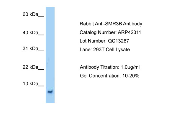 Host: Rabbit Target Name: SMR3B Sample Tissue: Human 293T Whole Cell Antibody Dilution: 1ug/ml