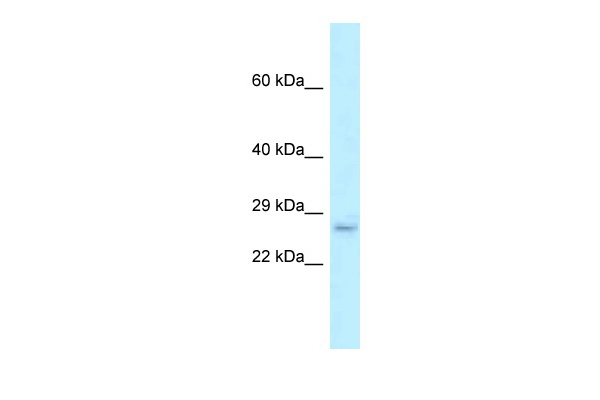 WB Suggested Anti-Fam176b Antibody Titration: 1.0 ug/ml Positive Control: Rat Lung