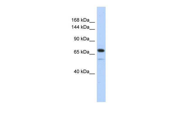 Western blot analysis of extracts of various cell lines, using TFAM   antibody (TA382445) at 1:1000 dilution.|Secondary antibody: HRP Goat Anti-Rabbit IgG (H+L) at 1:10000 dilution.|Lysates/proteins: 25ug per lane.|Blocking buffer: 3% nonfat dry milk in TBST.|Detection: ECL Basic Kit .|Exposure time: 1s.