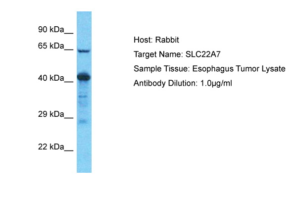 Host: Rabbit Target Name: SLC22A7 Sample Tissue: Human Esophagus Tumor Antibody Dilution: 1ug/ml