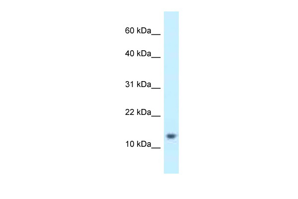 WB Suggested Anti-NBLA00301 Antibody Titration: 1.0 ug/ml Positive Control: 721_B Whole CellHAND2-AS1 is supported by BioGPS gene expression data to be expressed in 721_B