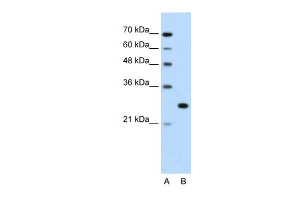WB Suggested Anti-FOXR2 Antibody Titration: 1.25ug/ml Positive Control: Jurkat cell lysate