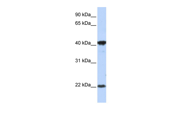WB Suggested Anti-LIN7°C Antibody Titration: 1 ug/ml Positive Control: MCF-7 whole cell lysatesLIN7°C is supported by BioGPS gene expression data to be expressed in MCF7