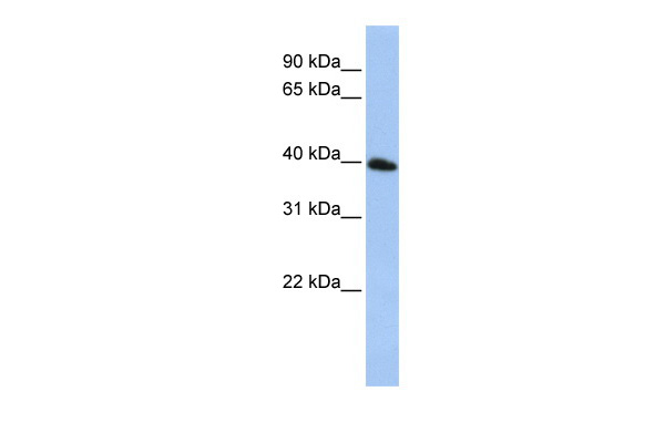 WB Suggested Anti-TSPAN17 Antibody Titration: 0.2-1 ug/ml ELISA Titer: 1:62500 Positive Control: HepG2 cell lysate