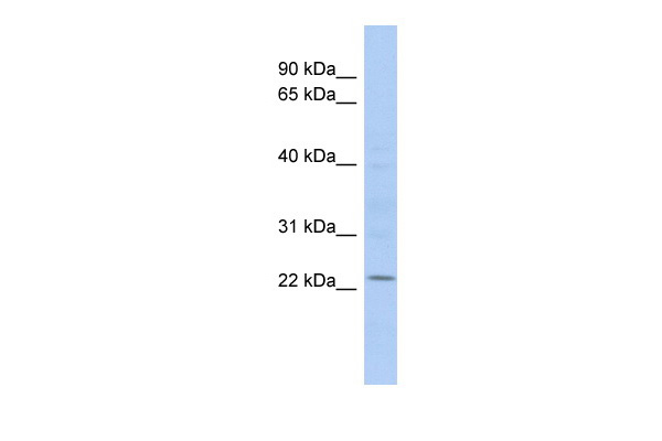 WB Suggested Anti-UBE2E1 Antibody Titration: 0.2-1 ug/ml ELISA Titer: 1:312500 Positive Control: COLO205 cell lysate