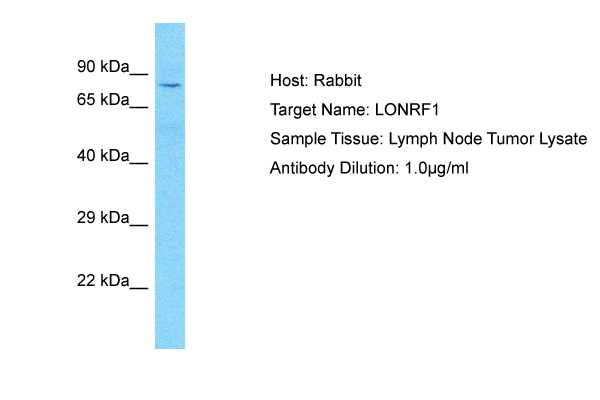 Host: Rabbit Target Name: LONRF1 Sample Type: Lymph Node Tumor lysates Antibody Dilution: 1.0ug/ml