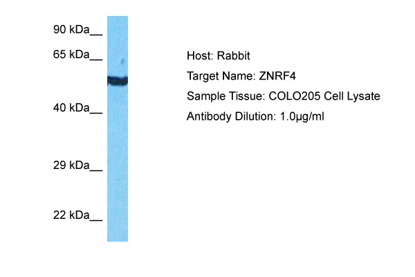 Host: Rabbit Target Name: ZNRF4 Sample Type: COLO205 Whole Cell lysates Antibody Dilution: 1.0ug/ml