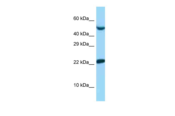 WB Suggested Anti-UBE2E1 Antibody Titration: 1.0 ug/ml Positive Control: 721_B Whole CellUBE2E1 is supported by BioGPS gene expression data to be expressed in 721_B