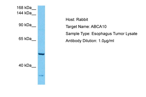 Host: Rabbit Target Name: ABCA10 Sample Tissue: Human Esophagus Tumor lysates Antibody Dilution: 1ug/ml