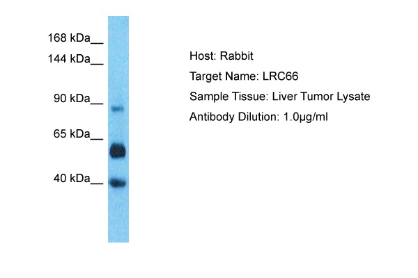 Host: Rabbit Target Name: LRC66 Sample Type: Liver Tumor lysates Antibody Dilution: 1.0ug/ml
