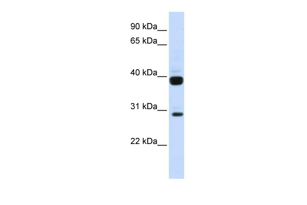 WB Suggested Anti-FLT3LG Antibody Titration: 0.2-1 ug/ml ELISA Titer: 1:312500 Positive Control: Human Muscle