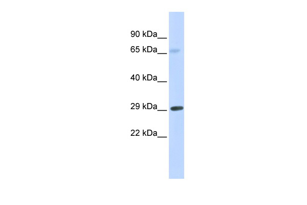 WB Suggested Anti-FCER1A Antibody Titration: 0.2-1 ug/ml ELISA Titer: 1:62500 Positive Control: Human Muscle