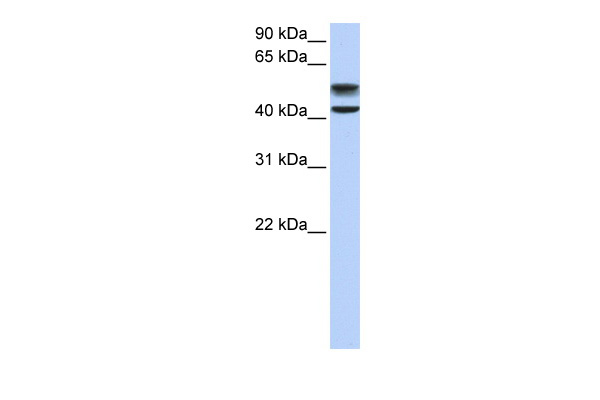 Western blot analysis of extracts of various cell lines, using DNA topoisomerase II alpha (DNA topoisomerase II alpha (TOP2A)) antibody (TA382708) at 1:1000 dilution.|Secondary antibody: HRP Goat Anti-Rabbit IgG (H+L) at 1:10000 dilution.|Lysates/proteins: 25ug per lane.|Blocking buffer: 3% nonfat dry milk in TBST.|Detection: ECL Enhanced Kit .|Exposure time: 300s.