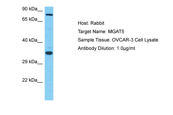 Host: Rabbit Target Name: MGAT5 Sample Type: OVCAR-3 Whole Cell lysates Antibody Dilution: 1.0ug/ml