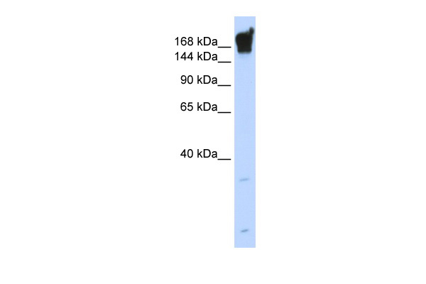 WB Suggested Anti-DYSF Antibody Titration: 0.2-1 ug/ml ELISA Titer: 1:12500 Positive Control: Human Muscle