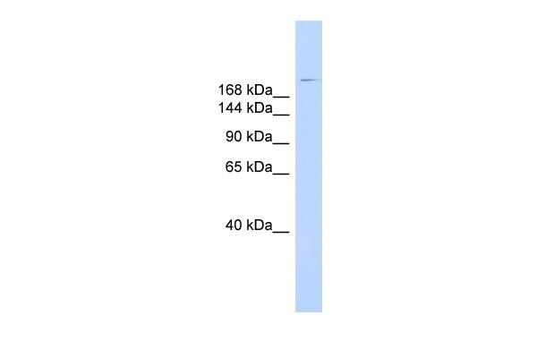 WB Suggested Anti-DYSF Antibody Titration: 0.2-1 ug/ml ELISA Titer: 1:1562500 Positive Control: Human Muscle