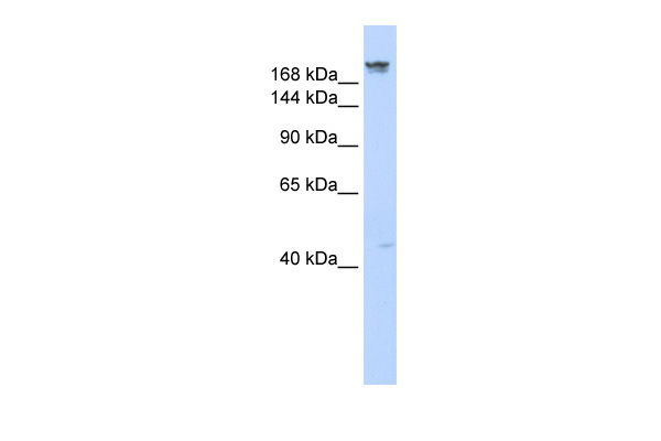 WB Suggested Anti-DYSF Antibody Titration: 0.2-1 ug/ml ELISA Titer: 1:312500 Positive Control: Human Muscle