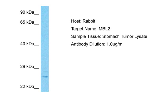 Host: Rabbit Target Name: MBL2 Sample Type: Stomach Tumor lysates Antibody Dilution: 1.0ug/ml