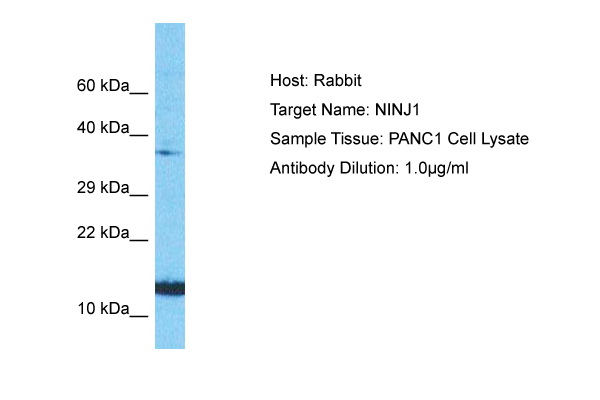 Host: Rabbit Target Name: NINJ1 Sample Type: PANC1 Whole Cell lysates Antibody Dilution: 1.0ug/ml