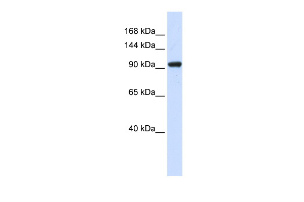 WB Suggested Anti-ZNF452 Antibody Titration: 0.2-1 ug/ml ELISA Titer: 1:62500 Positive Control: 293T cell lysate