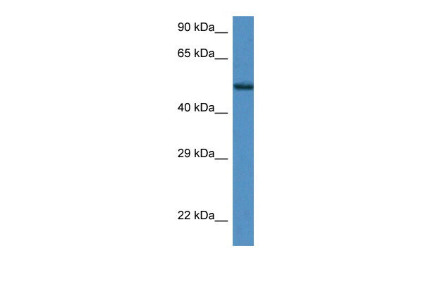 WB Suggested Anti-Zfp275 Antibody Titration: 1.0 ug/ml Positive Control: Mouse Kidney