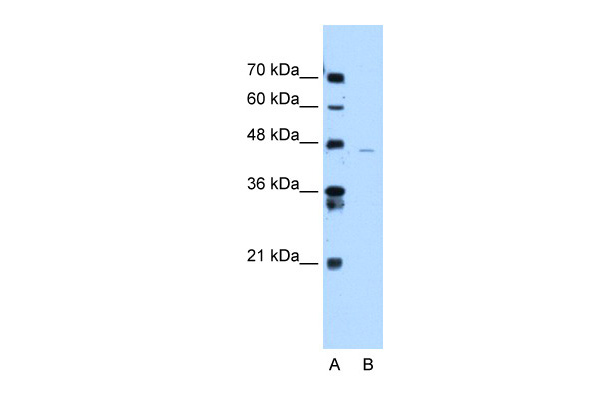 WB Suggested Anti-hCG_20426 Antibody Titration: 0.2-1 ug/ml Positive Control: Jurkat cell lysate