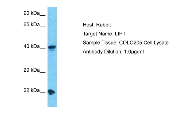 Host: Rabbit Target Name: LIPT Sample Type: COLO205 Whole Cell lysates Antibody Dilution: 1.0ug/ml