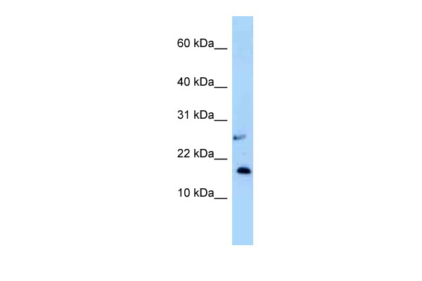 WB Suggested Anti-Nudt15 Antibody Titration: 1.0 ug/ml Positive Control: Mouse Small Intestine