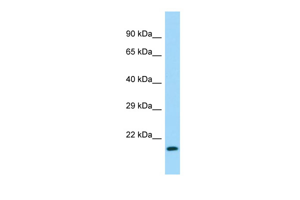 Dot-blot analysis of all sorts of peptides using K48-linkage Specific Polyubiquitin antibody (TA382992) at 1:1000 dilution.