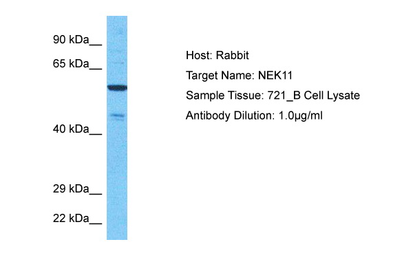 Dot-blot analysis of all sorts of peptides using K63-linkage Specific Polyubiquitin antibody (TA382993) at 1:1000 dilution.