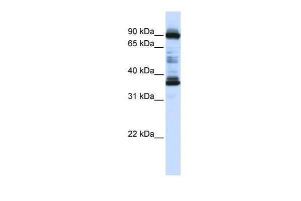 WB Suggested Anti-LOC645015 Antibody Titration: 0.2-1 ug/ml ELISA Titer: 1:312500 Positive Control: Human Placenta