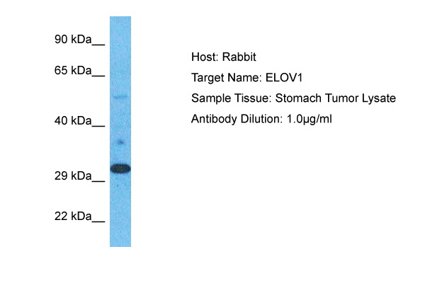 Host: Rabbit Target Name: ELOV1 Sample Type: Stomach Tumor lysates Antibody Dilution: 1.0ug/ml