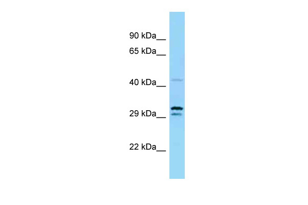 WB Suggested Anti-Uba5 Antibody Titration: 1.0 ug/ml Positive Control: Mouse Thymus