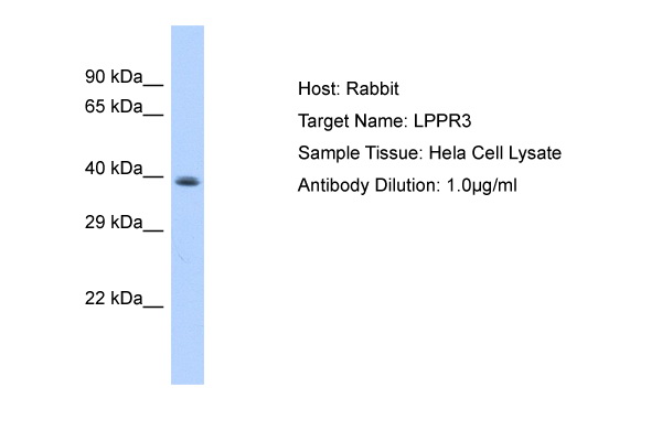 Host: Rabbit Target Name: LPPR3 Sample Type: Hela Whole Cell lysates Antibody Dilution: 1.0ug/ml