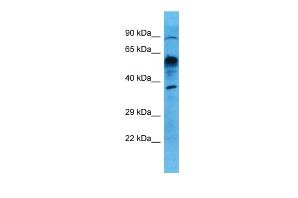 Host: Rabbit Target Name: UXS1 Sample Type: Lung Tumor lysates Antibody Dilution: 1.0ug/ml
