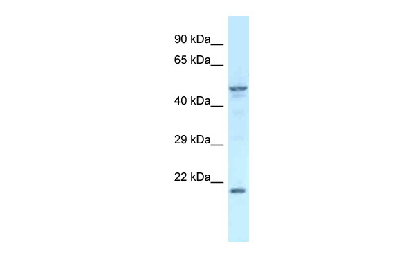 WB Suggested Anti-Zfp113 Antibody Titration: 1.0 ug/ml Positive Control: Mouse Kidney