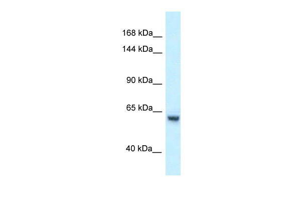 WB Suggested Anti-Zfp354a Antibody Titration: 1.0 ug/ml Positive Control: Mouse thymus