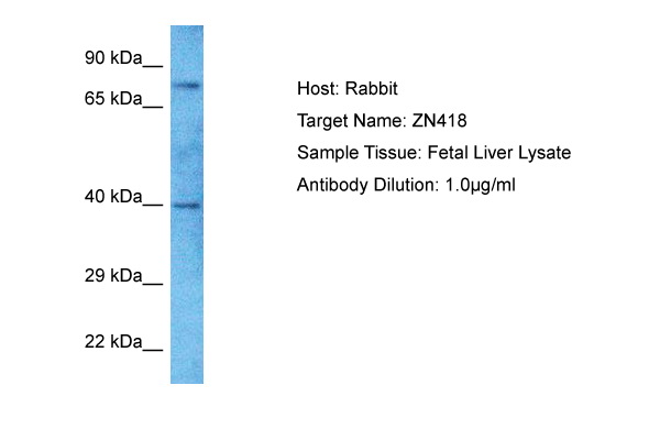 Host: Rabbit Target Name: ZN418 Sample Type: Fetal Liver lysates Antibody Dilution: 1.0ug/ml