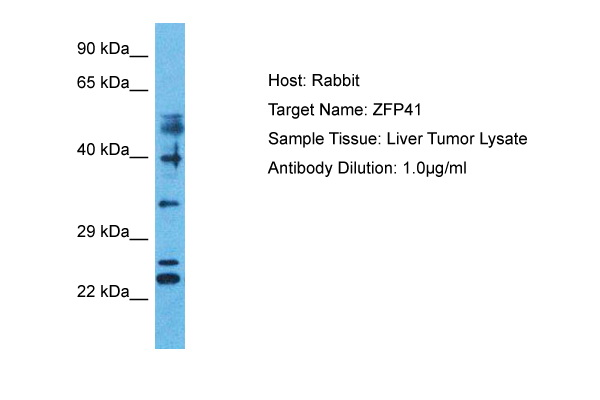 Host: Rabbit Target Name: ZFP41 Sample Type: Liver Tumor lysates Antibody Dilution: 1.0ug/ml
