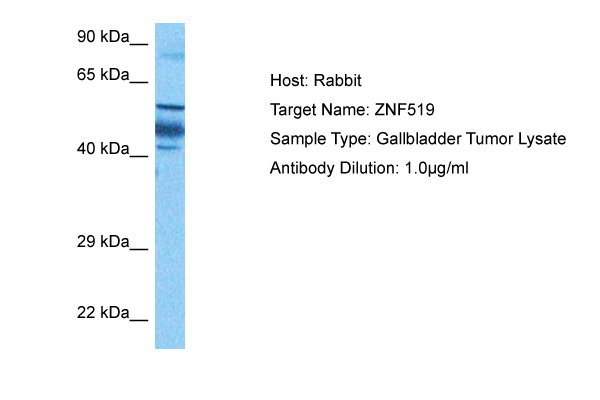 Host: Rabbit Target Name: ZNF519 Sample Tissue: Human Gallbladder Tumor lysates Antibody Dilution: 1ug/ml