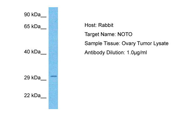Host: Rabbit Target Name: NOTO Sample Type: Ovary Tumor lysates Antibody Dilution: 1.0ug/ml
