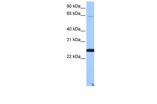WB Suggested Anti-LOC344065 Antibody Titration: 0.2-1 ug/ml Positive Control: Human Lung